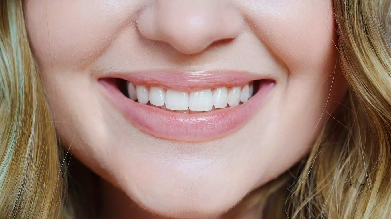 Smile after cosmetic dental treatment