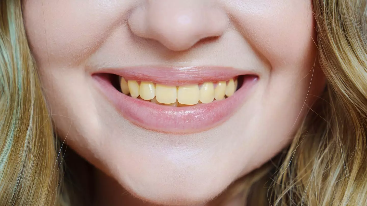 Smile before cosmetic dental treatment